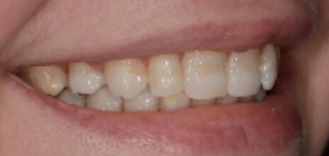 Before Image