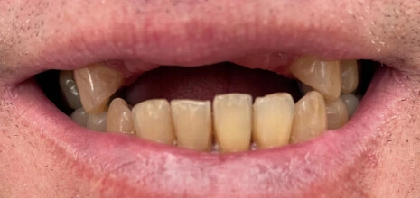 Real Smile Transformations
