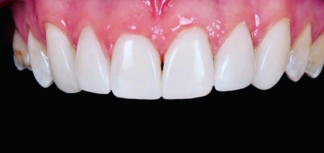 After Image